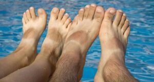Easy Home Remedies to Remove Sun Tan from Feet Remove Sun Tan from Feet